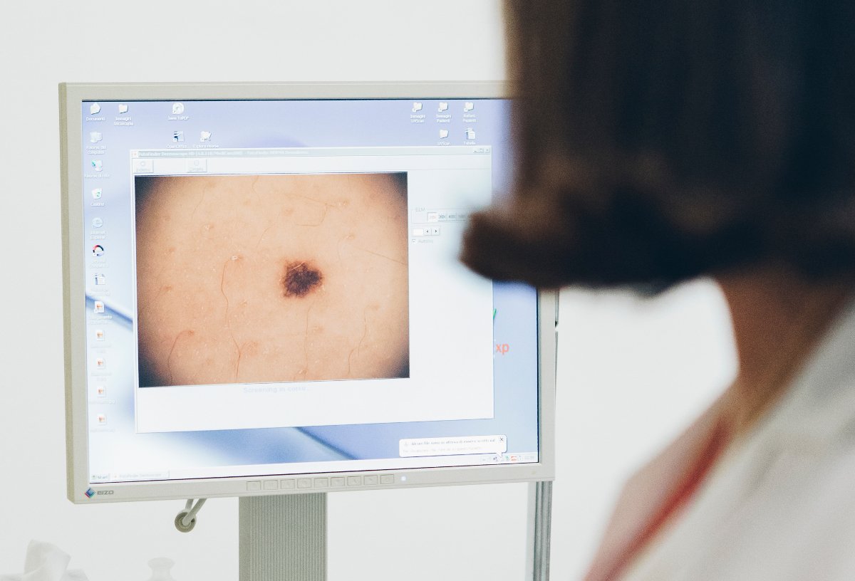 Dermoscopy and Dermlite lenses: what is it all about? - Dermatologia Prati
